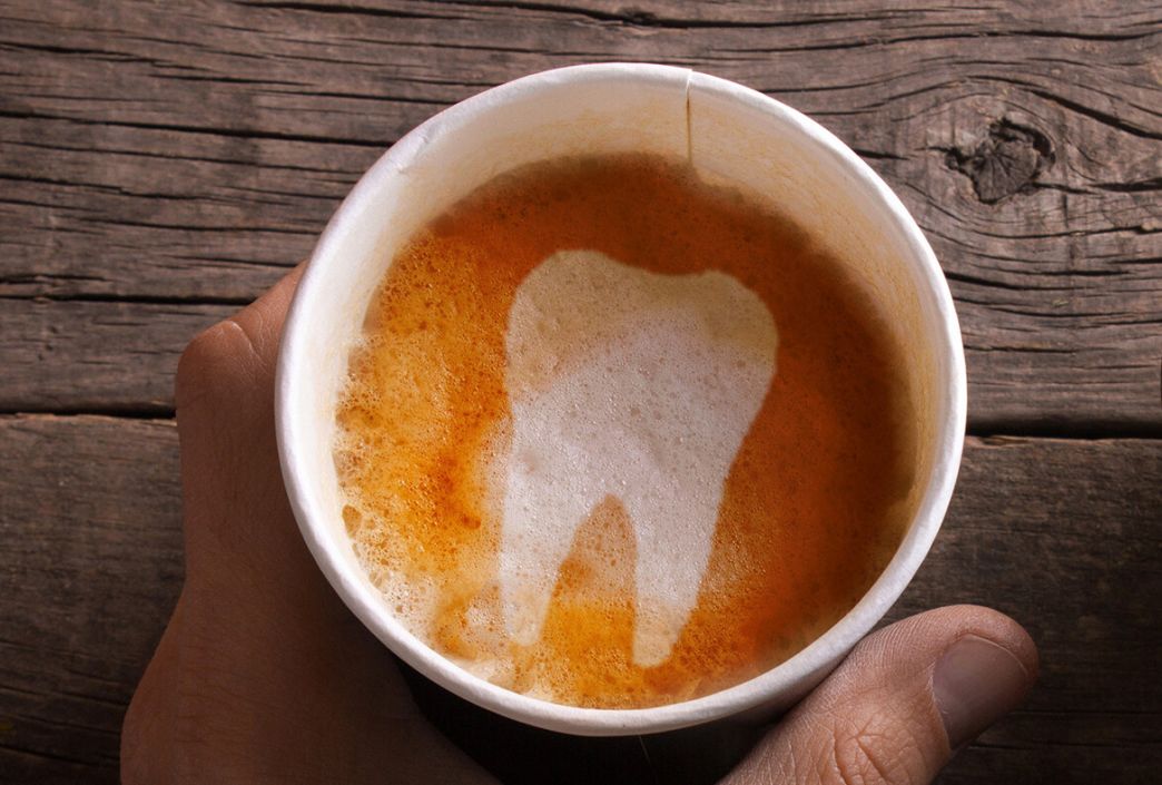Fogfehérítés után kávé?