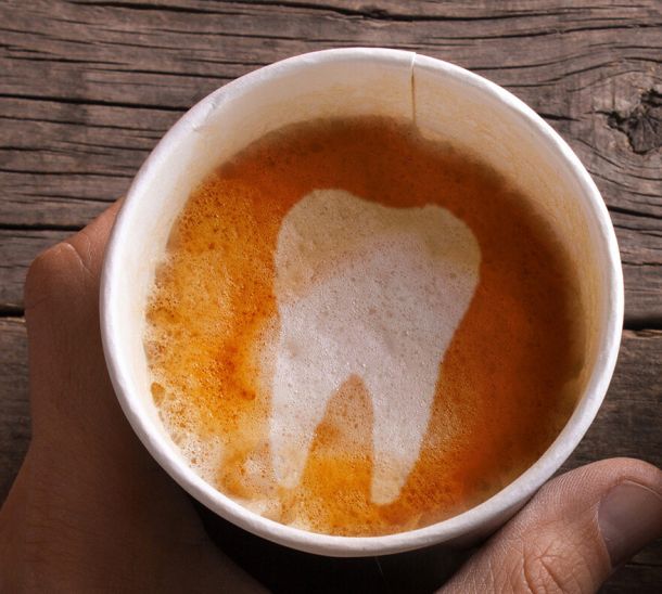 Fogfehérítés után kávé?